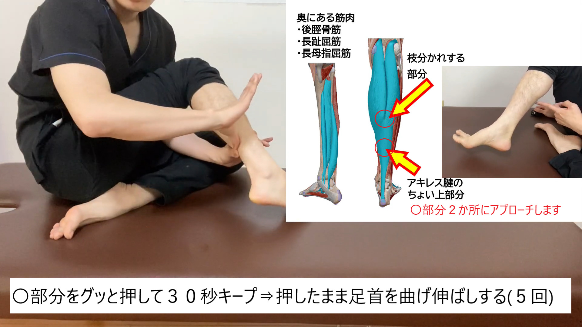 外反母趾手術後リハビリ用の装具 健康・医学